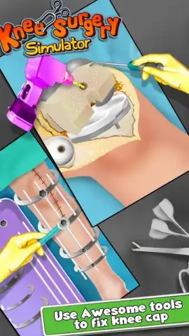 KneeSurgery скриншот 1