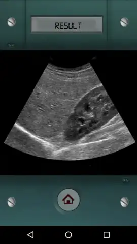 Scanner X-ray скриншот 3