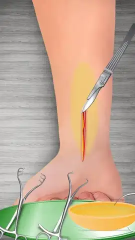 WristSurgeryDoctor скриншот 10