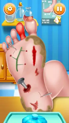 Foot Surgery Doctor Care скриншот 11