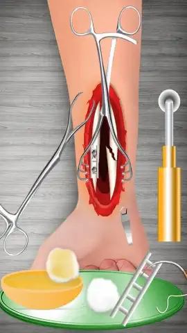 WristSurgeryDoctor скриншот 15