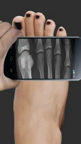 X Ray Scanner Pro скриншот 1
