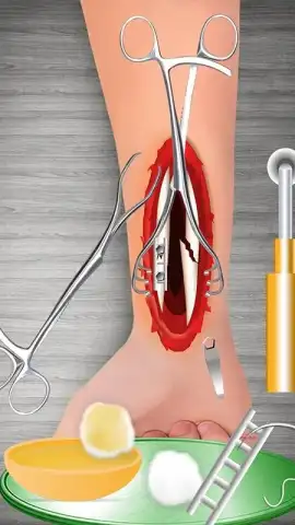 WristSurgeryDoctor скриншот 9