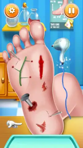 Foot Surgery Doctor Care скриншот 10