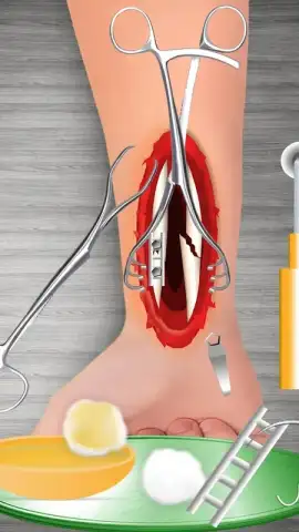 WristSurgeryDoctor скриншот 2
