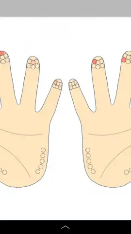 Diabetes:M скриншот 5